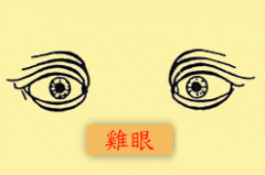 鸡眼