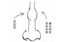 5种鼻子面相的女人克夫