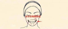 法令线破相有什么预兆吗？