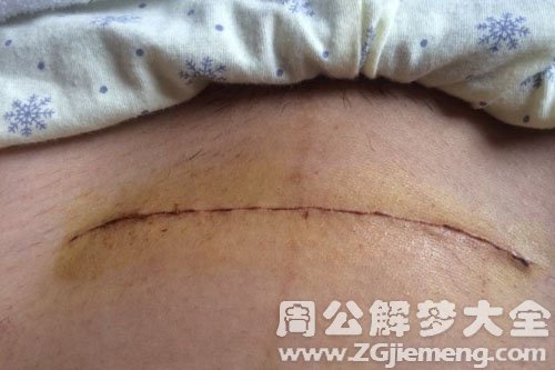 【梦见刀疤】